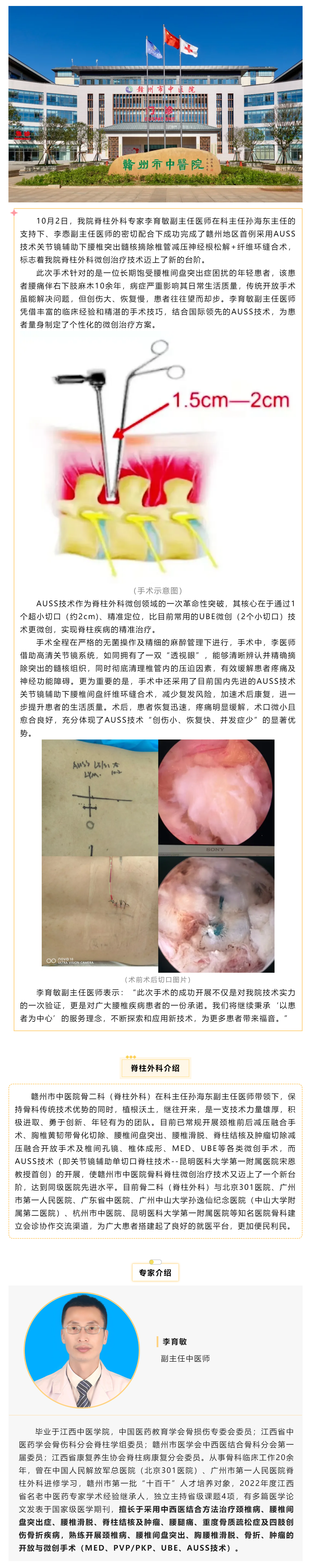 全市首例！我院成功實施AUSS技術關節鏡輔助下腰椎突出髓核摘除椎管減壓神經根松解+纖維環縫合術.png
