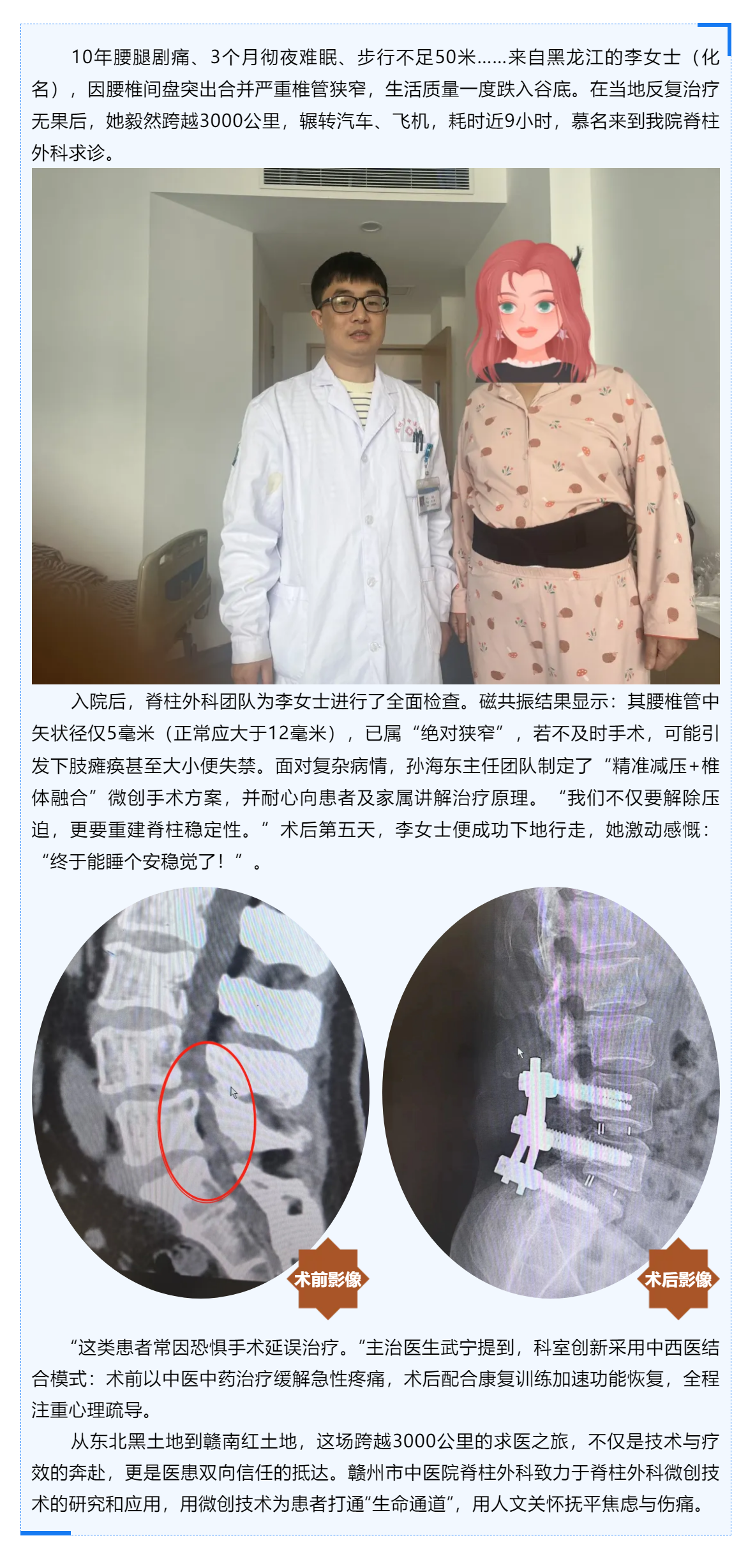 跨越山河的信任_贛州市中醫(yī)院巧手“疏堵”，腰椎狹窄患者3000公里求醫(yī)路終迎新生！.png